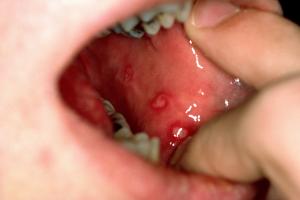 best dental clinic in Surat