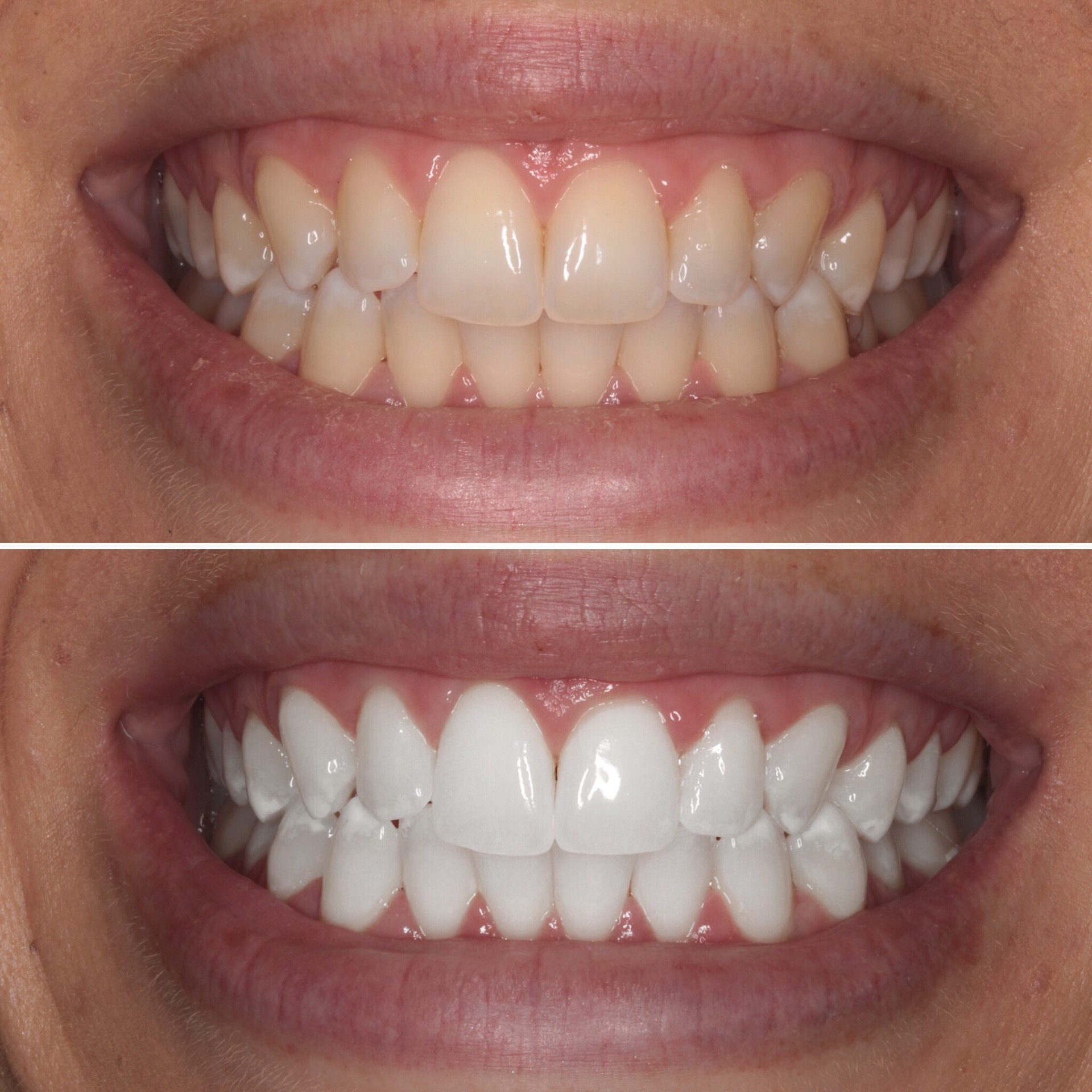 best dental clinic in Surat