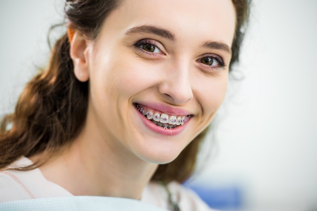 Best veneers teeth in Surat