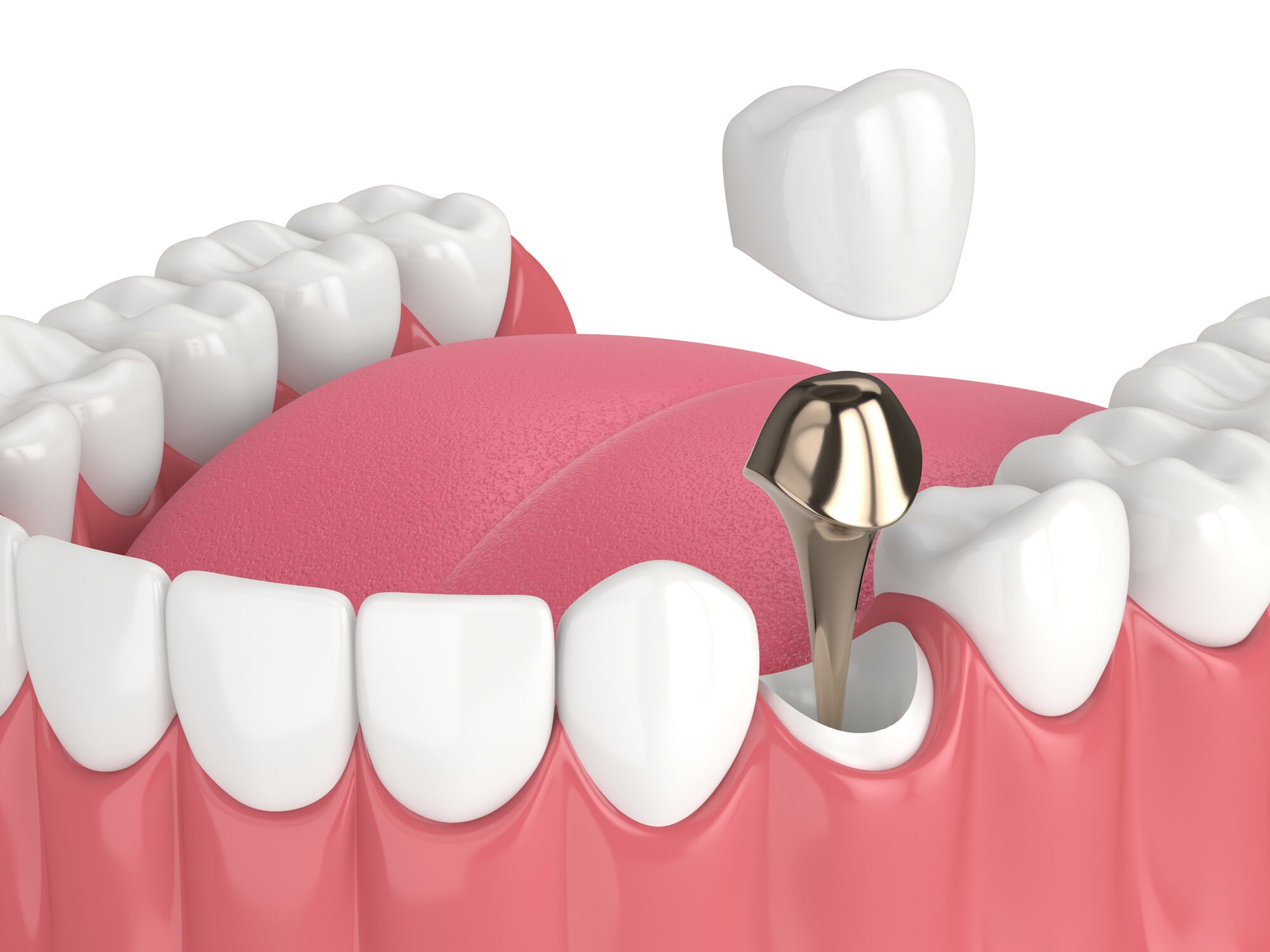best dental clinic in Surat