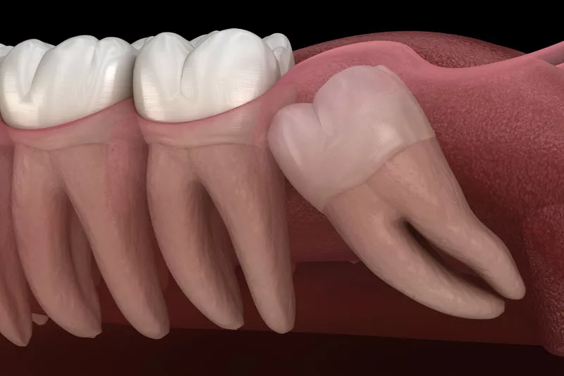 best dental clinic in Surat
